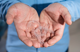 hands holding clear aligners, the future of teledentistry