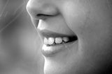 woman smiling with teeth, learning what nighttime aligners are.
