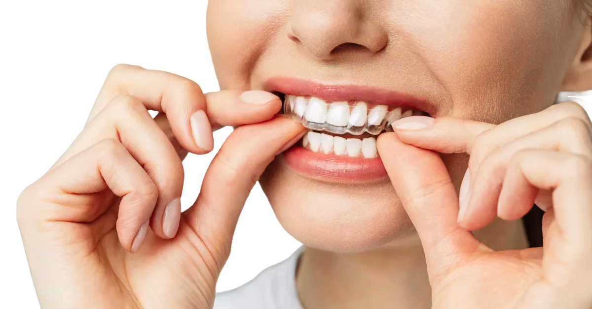 Smile Direct Club