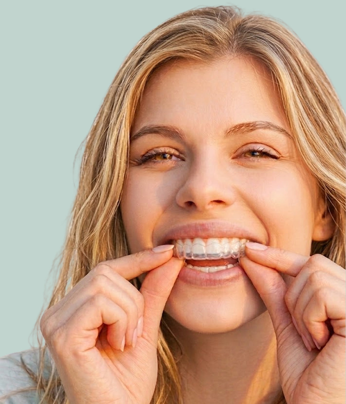 
Aligner Treatment