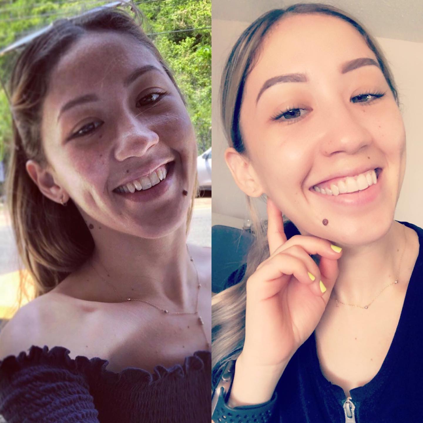 SmileSet Customer