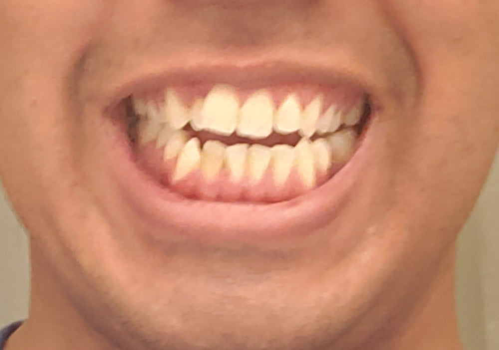 Before