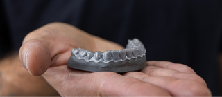 Aligners being custom crafted