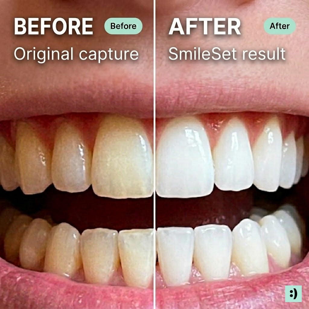 Before and after teeth whitening results with SmileSet