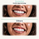 Aligner Treatment