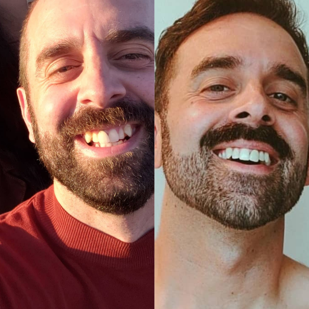 SmileSet Customer
