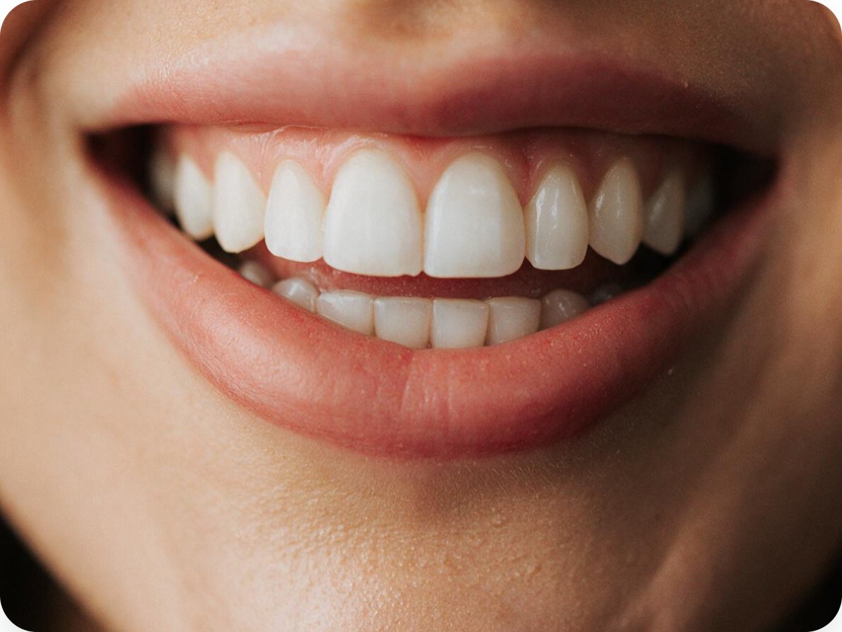 Smile with straight front teeth