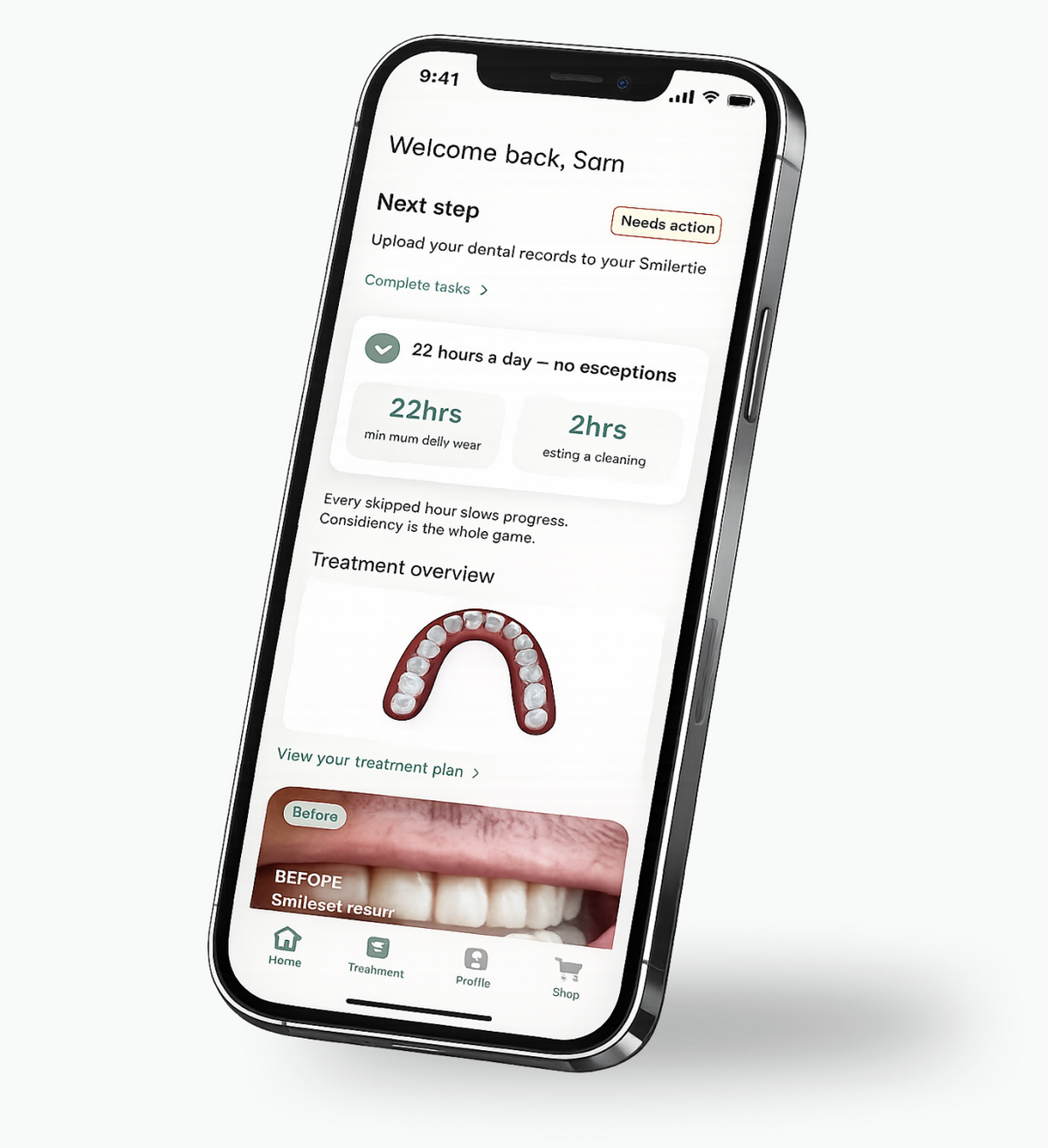 The SmileSet app on a phone