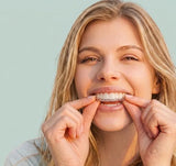 smileset-aligner-treatment.webp