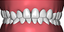 Watch your teeth straighten